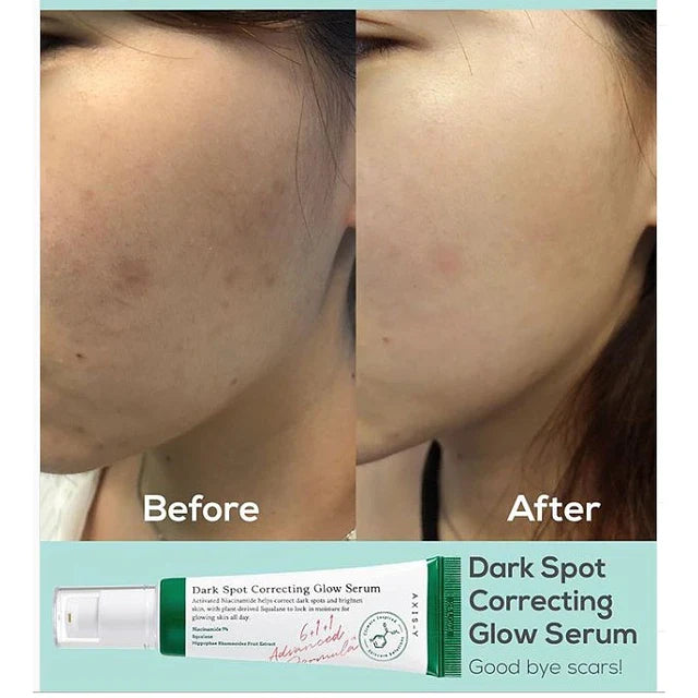 AXIS-Y DARK SPOT CORRECTING GLOW SERUM